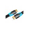 Кабель мультимедійний HDMI M to HDMI M 1.5m 4K60Hz black Vention (VAA-B02-L150) - Зображення 2