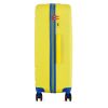 Чемодан Semi Line 28 (L) Yellow (T5929-3) (DAS303423) - Изображение 3