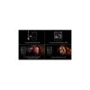 Стайлер Dyson Airwrap I.D. HS08 T3/T4 Curly+Coily Red Velvet/Gold (596928-01) - Изображение 1